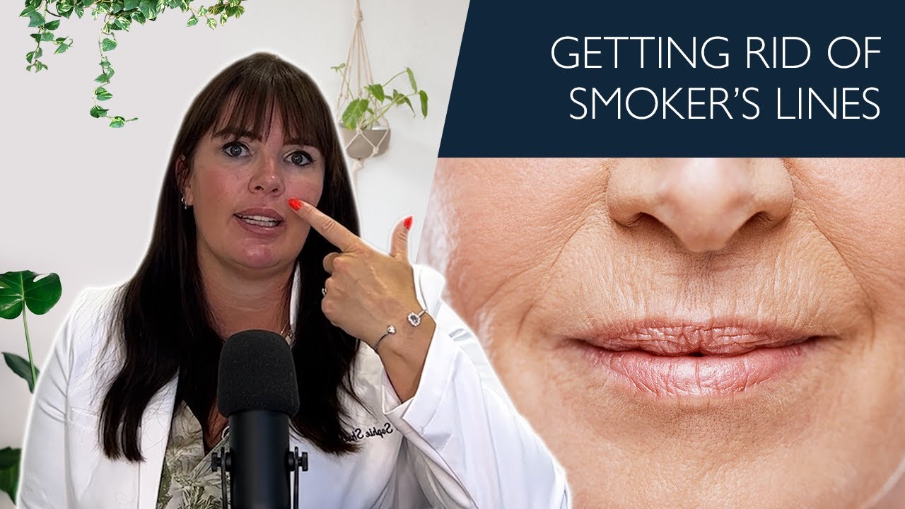 How To Get Rid Of Smoker's Lines Non-Surgically