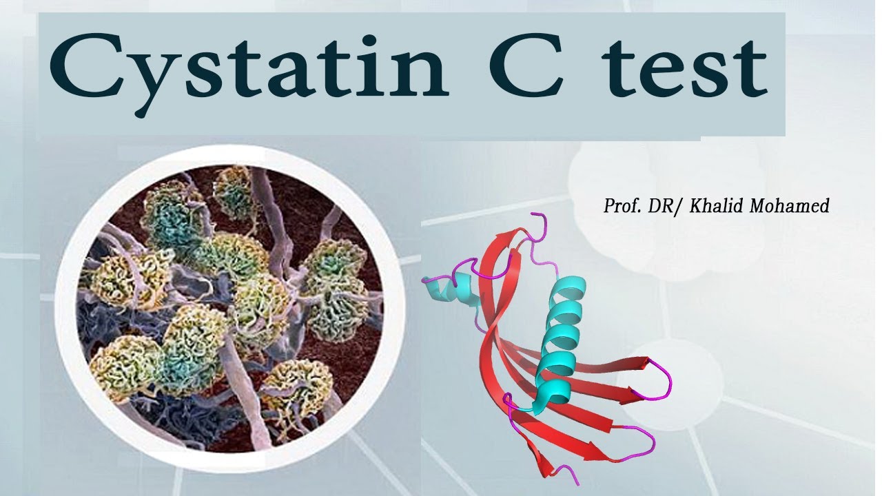 Cystatin C Test & Its Clinical Value