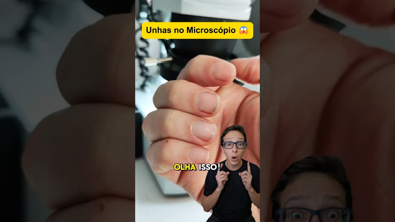 Unhas no Microsc&oacute;pio 😱#medicina#medico #enfermagem #microscopio #enfermeira #dermatologia Comer unha