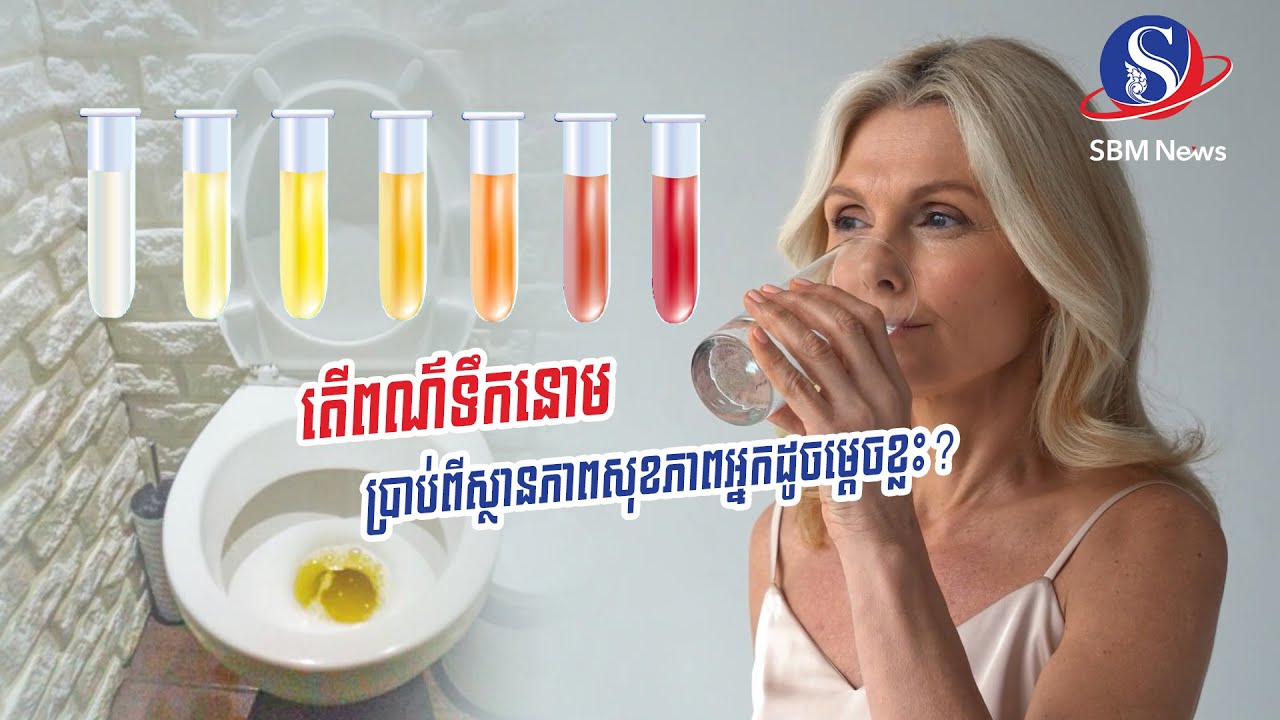 តើពណ៌ទឹកនោម ប្រាប់ពីស្ថានភាពសុខភាពអ្នកដូចម្ដេចខ្លះ?