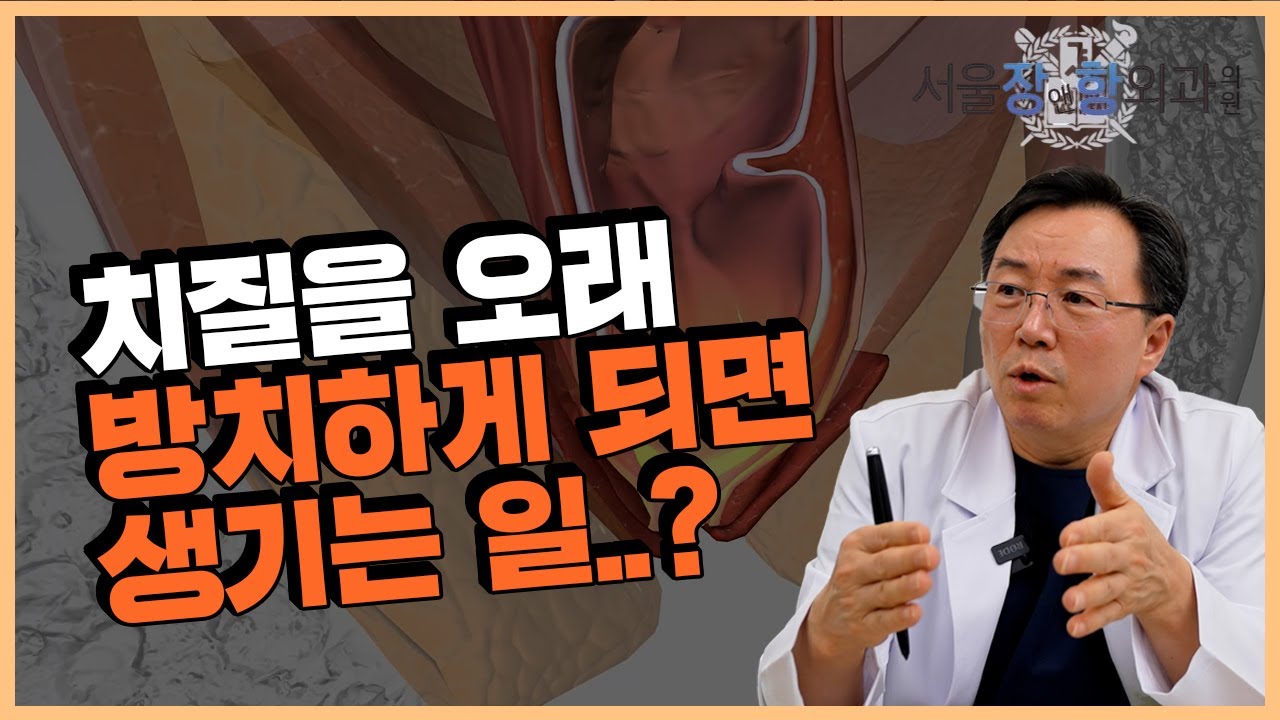 치질을 오래 방치하게 되면 생기는 일? ㅣ서울장앤항외과