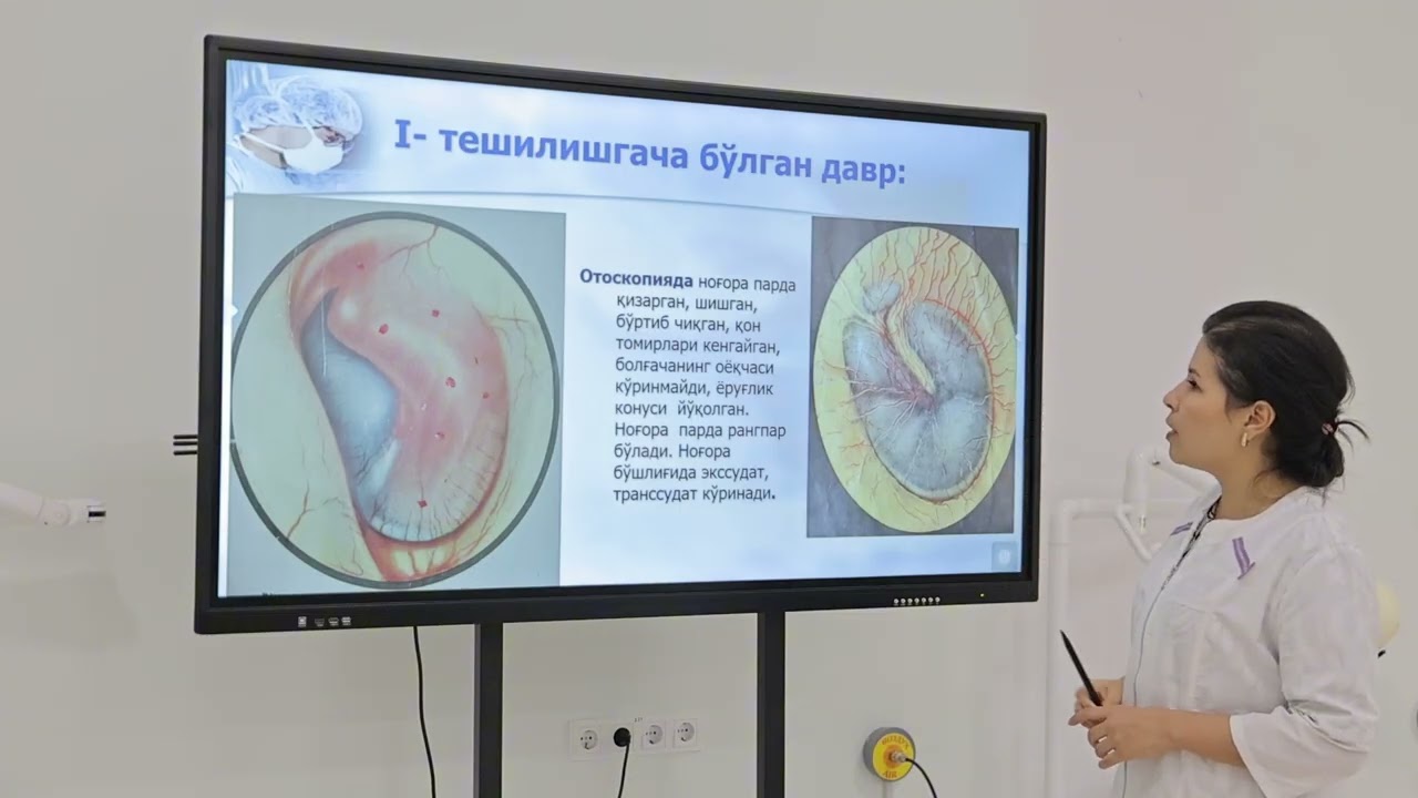 O&rsquo;tkir o&rsquo;rta otit etiologiyasi, klinikasi, tashxisoti hamda davolash usullari