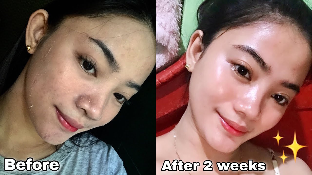 RYX CLEAR BOMB FINAL UPDATE | HONEST REVIEW | Updated Skincare Routine Glass Skin | Mhelai Magpantay