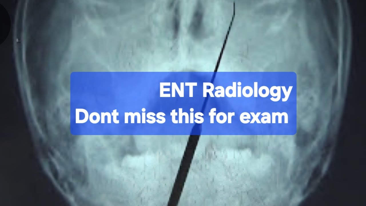 Xrays In ENT made easy | Radiology Questions for Exams