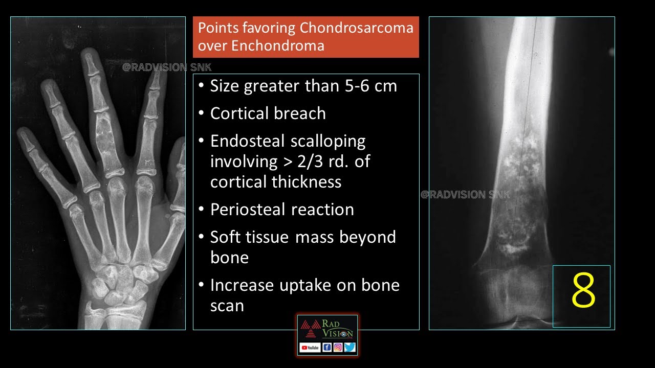 Radiology spotters - Exam going students- set IV