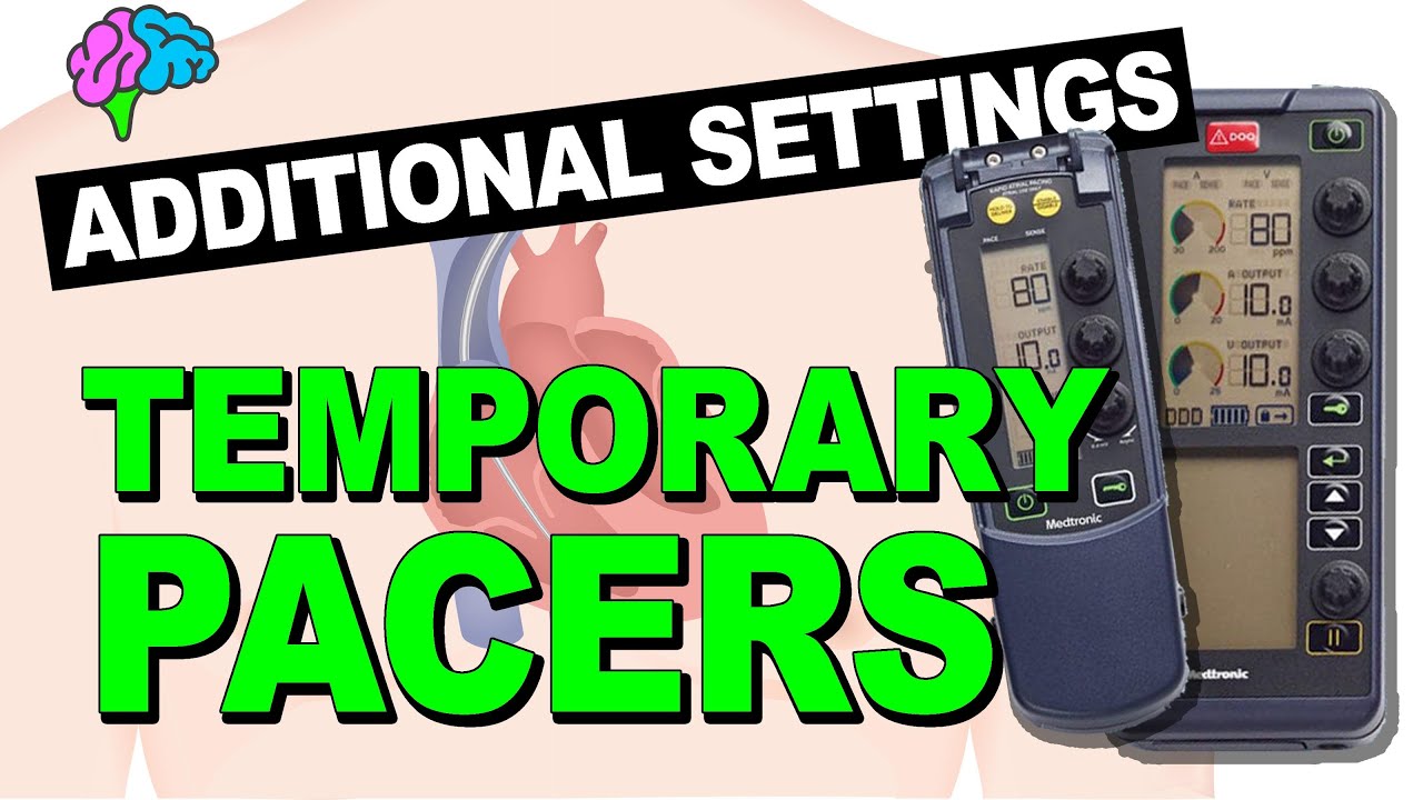 Additional Settings for Temporary Pacemakers