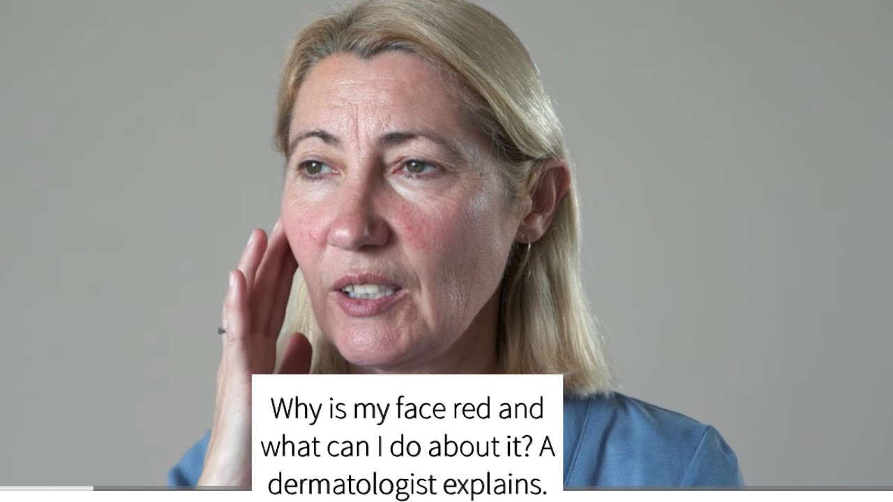 Why is my face red?