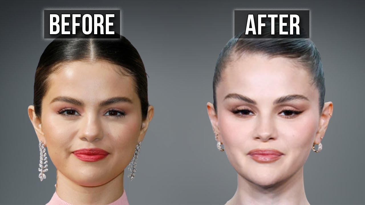 Selena Gomez’s Plastic Surgery Tells a Story… and It’s Not What You Think ​