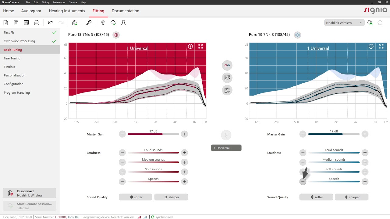 Basic Tuning in Connexx 9 | Signia Hearing Aids