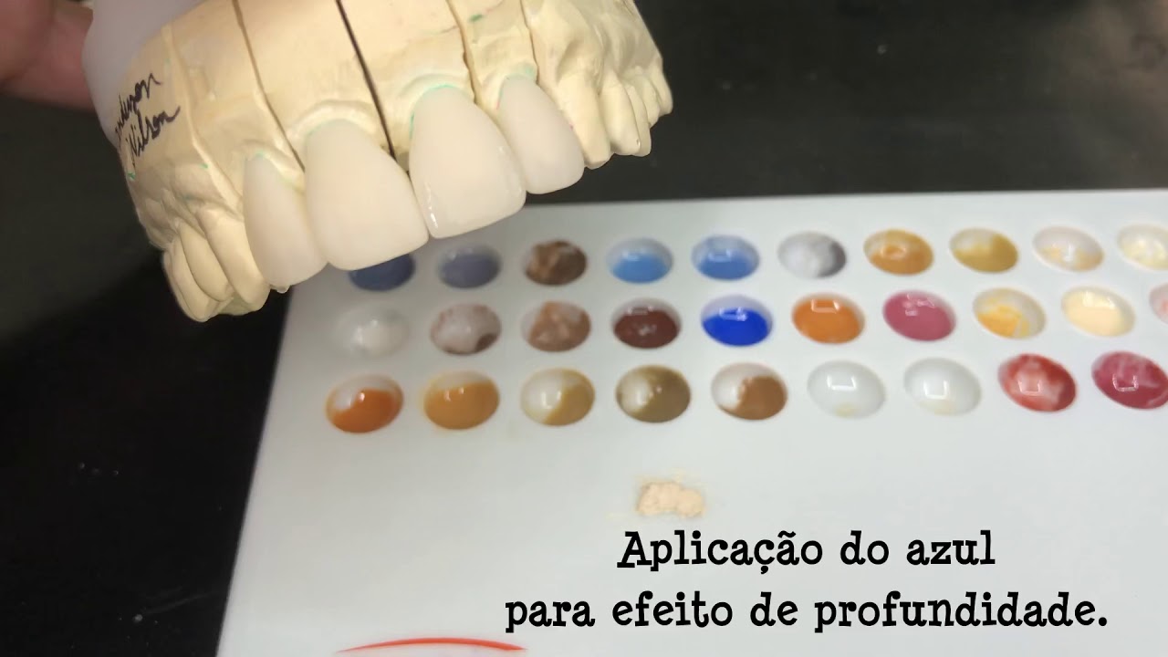 EMax incisal maquiada