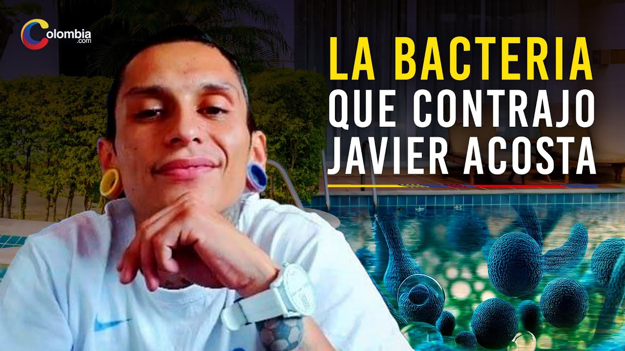 la bacteria que llev&oacute; a joven influencer a pedir la eutanasia, la contrajo en una piscina en Melgar