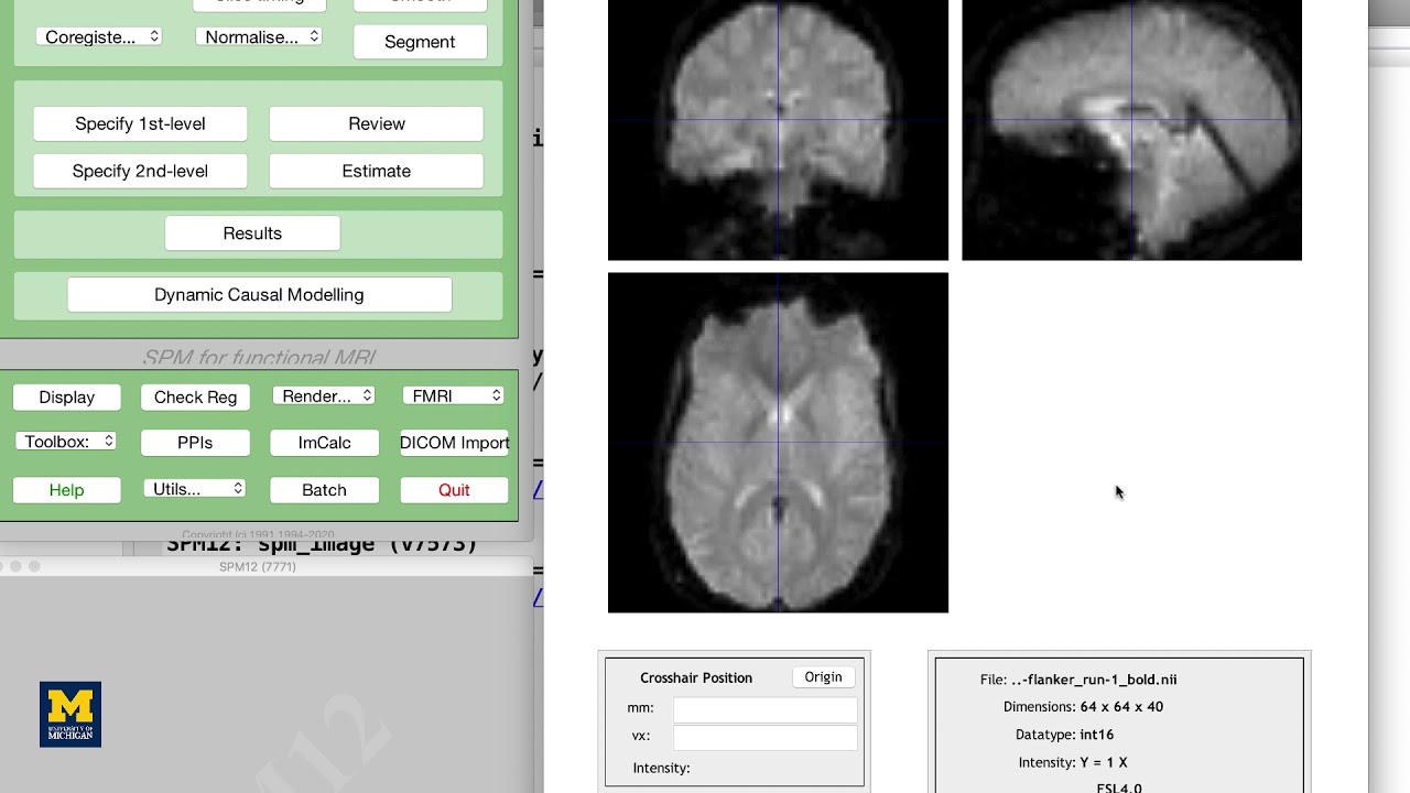 SPM Tutorial #3: Looking at the Data