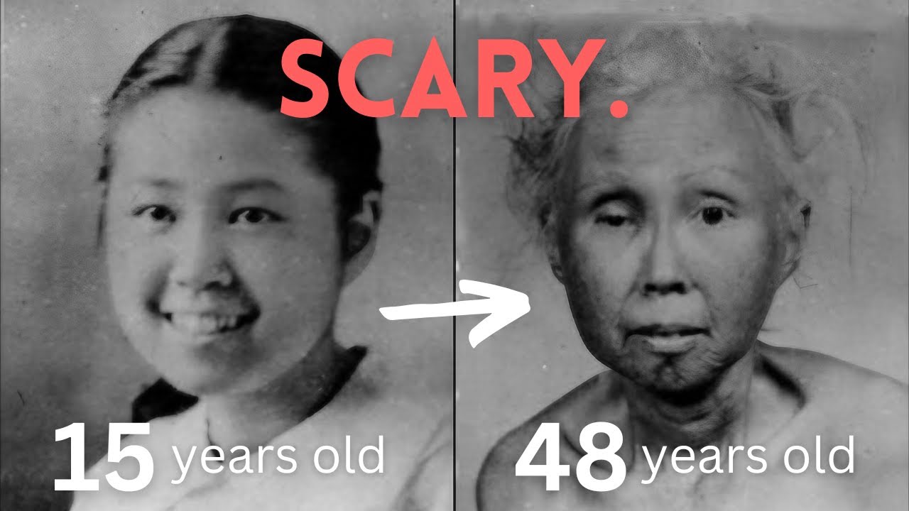 This rare disease speeds up how fast you age.