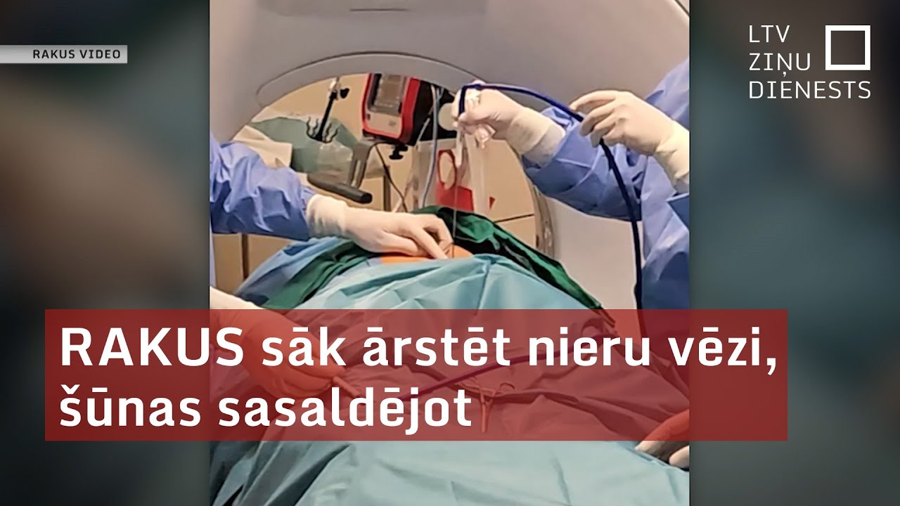 RAKUS sāk ārstēt nieru vēzi, šūnas sasaldējot