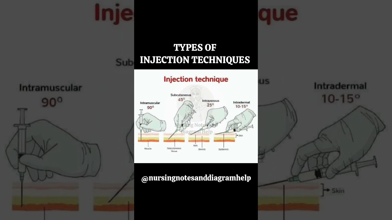 Types of Injection Techniques// Injection Techniques #nursingnotesanddiagramhelp #education#nursing