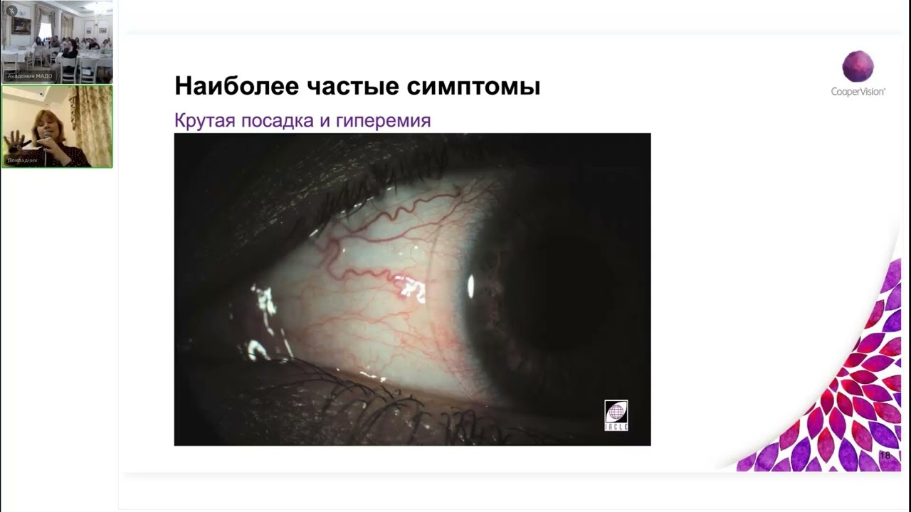 Оптометрический форум 2024: Ливадина М.А. «Проблемы носителей контактных линз: как их решить?»