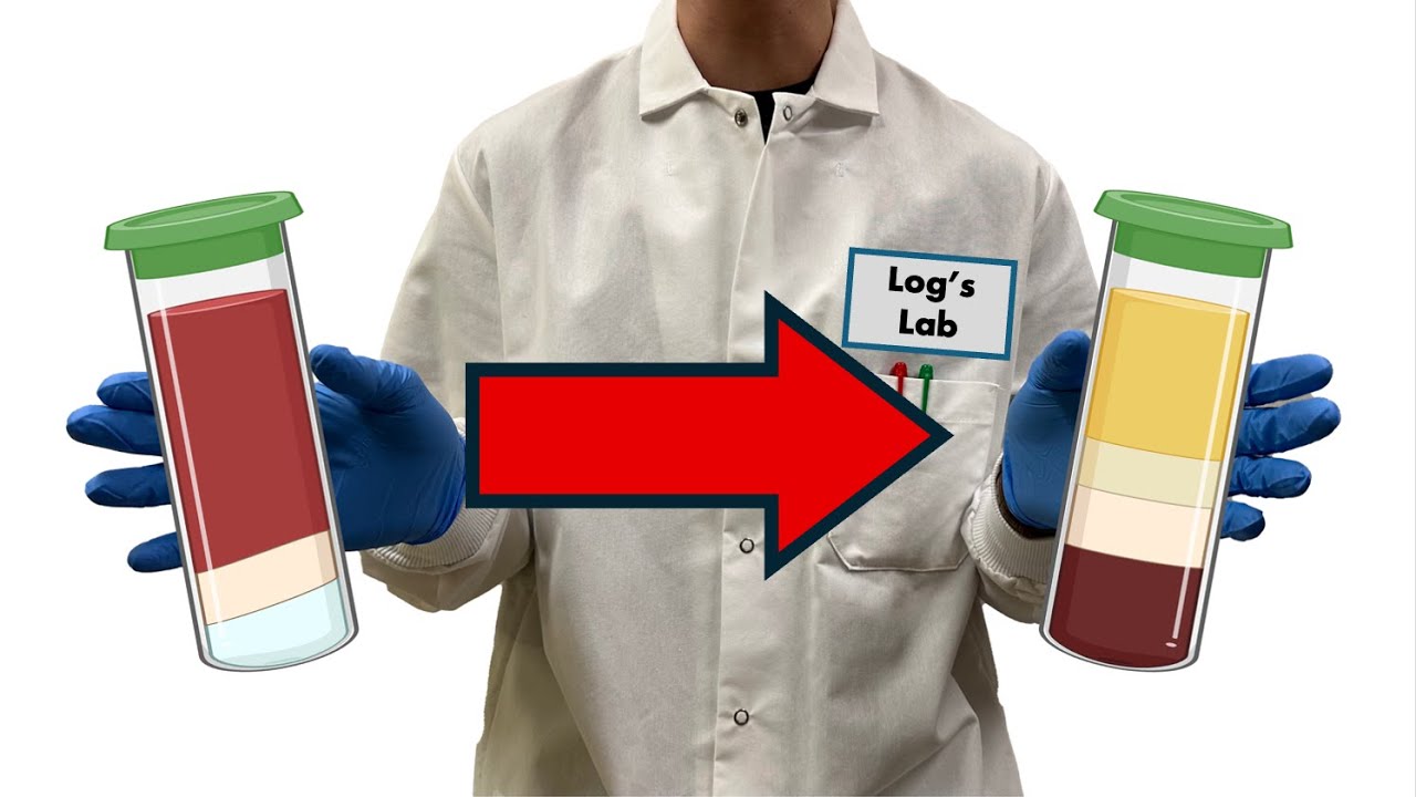 How to Isolate PBMCs from Whole Blood Using Ficoll (+ Troubleshooting Common Issues)