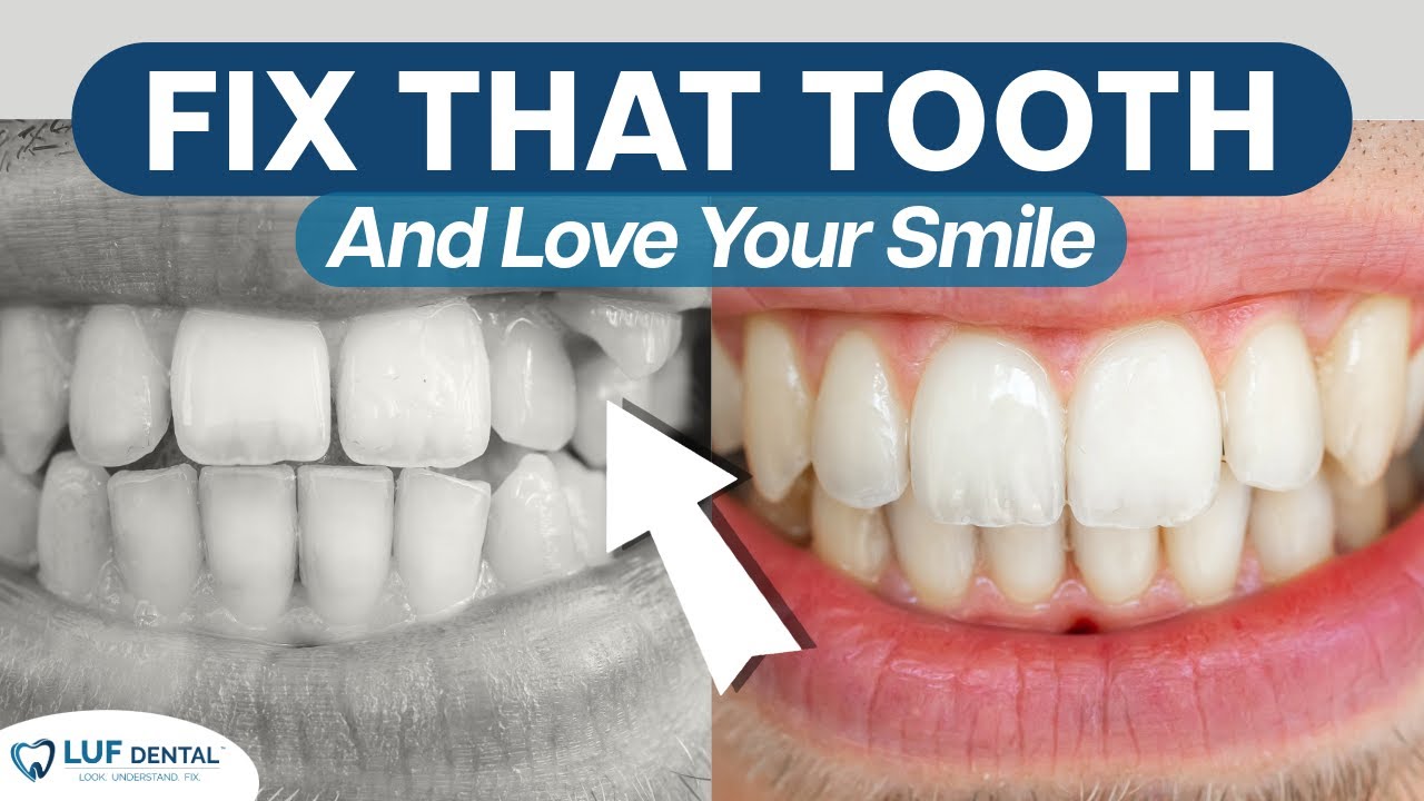 Confused About Your Smile? Watch This! 🦷 [Temple TX Dentist]