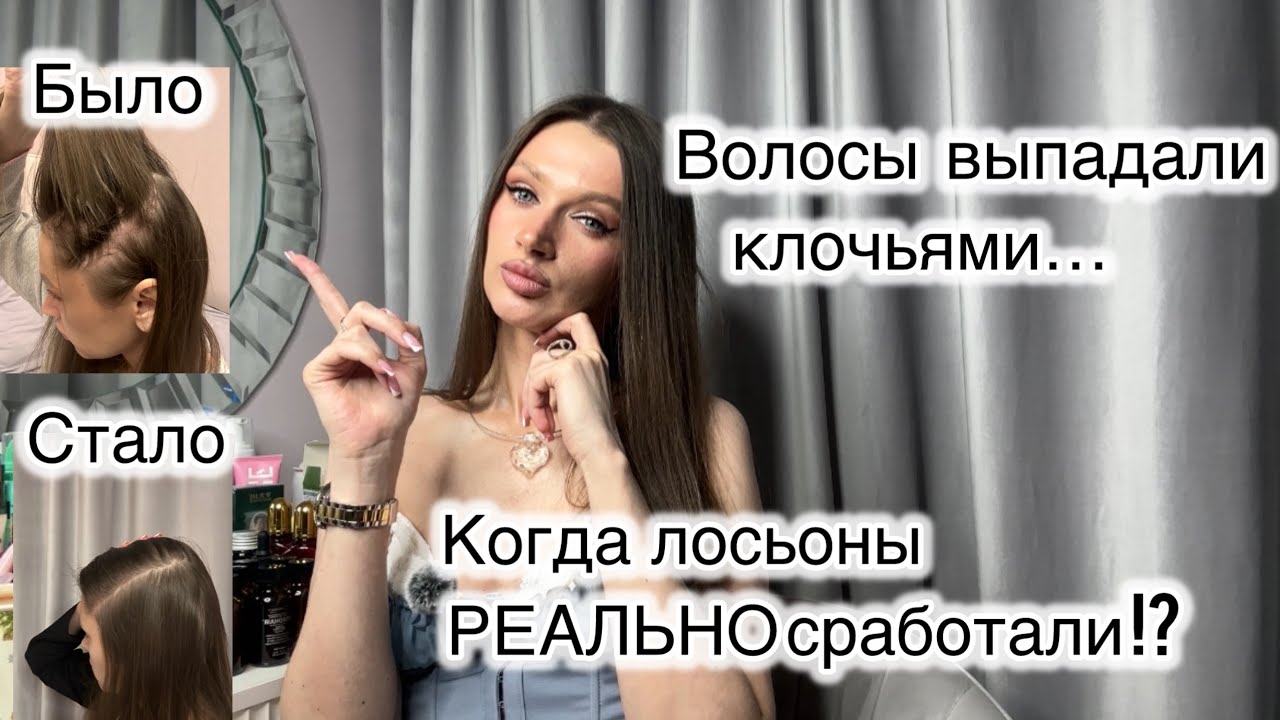 Что делают лосьоны и когда ждать эффект!? Лечение алопеции 