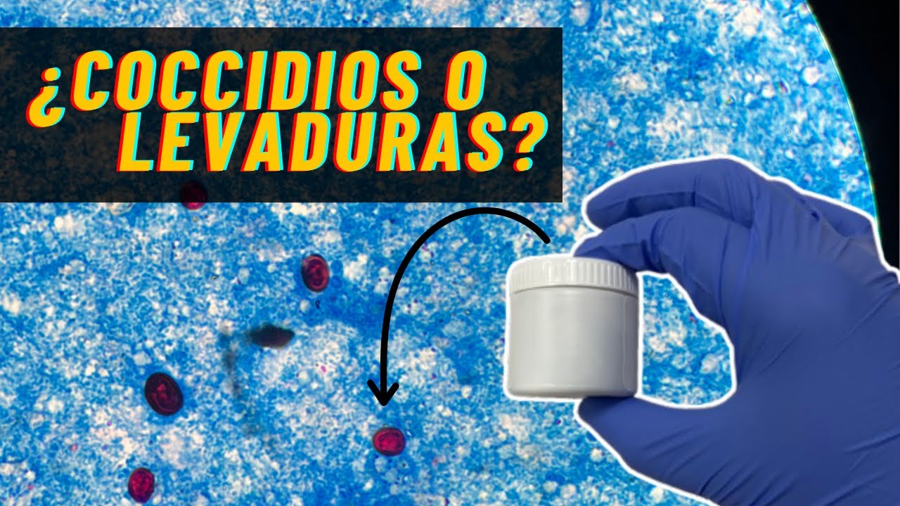Coccidios o levaduras: error diagn&oacute;stico frecuente.