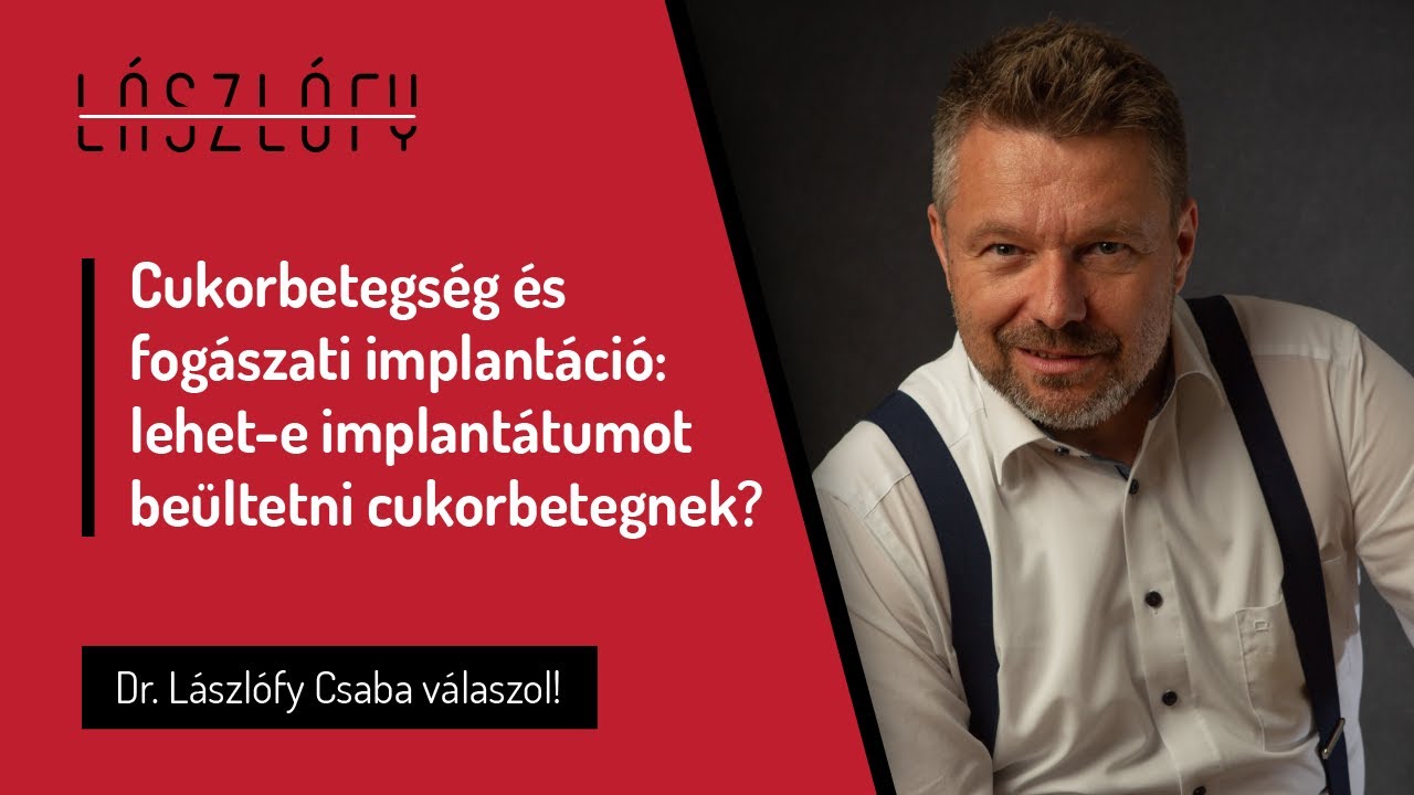Cukorbetegség és fogászati implantáció: lehet-e implantátumot beültetni cukorbetegeknek?