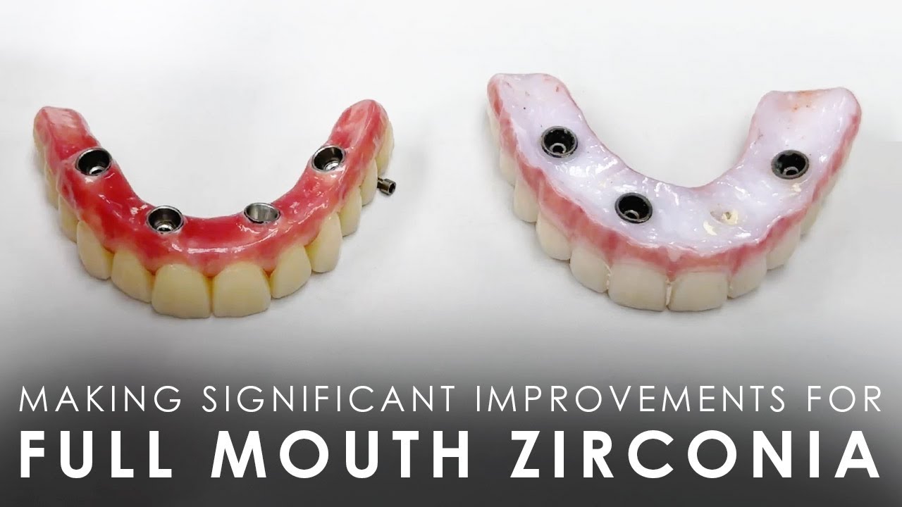 Making Significant Improvements for Full Mouth Zirconia