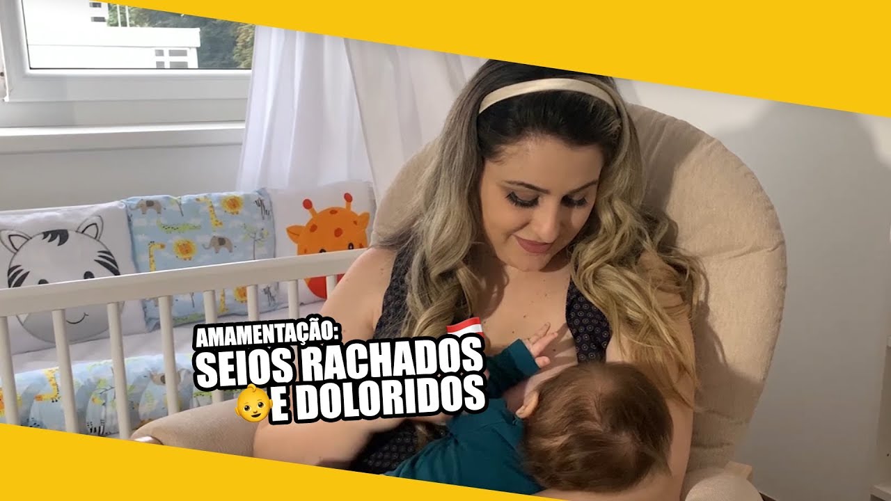 SEIOS RACHADOS e DOLORIDOS: amamenta&ccedil;&atilde;o