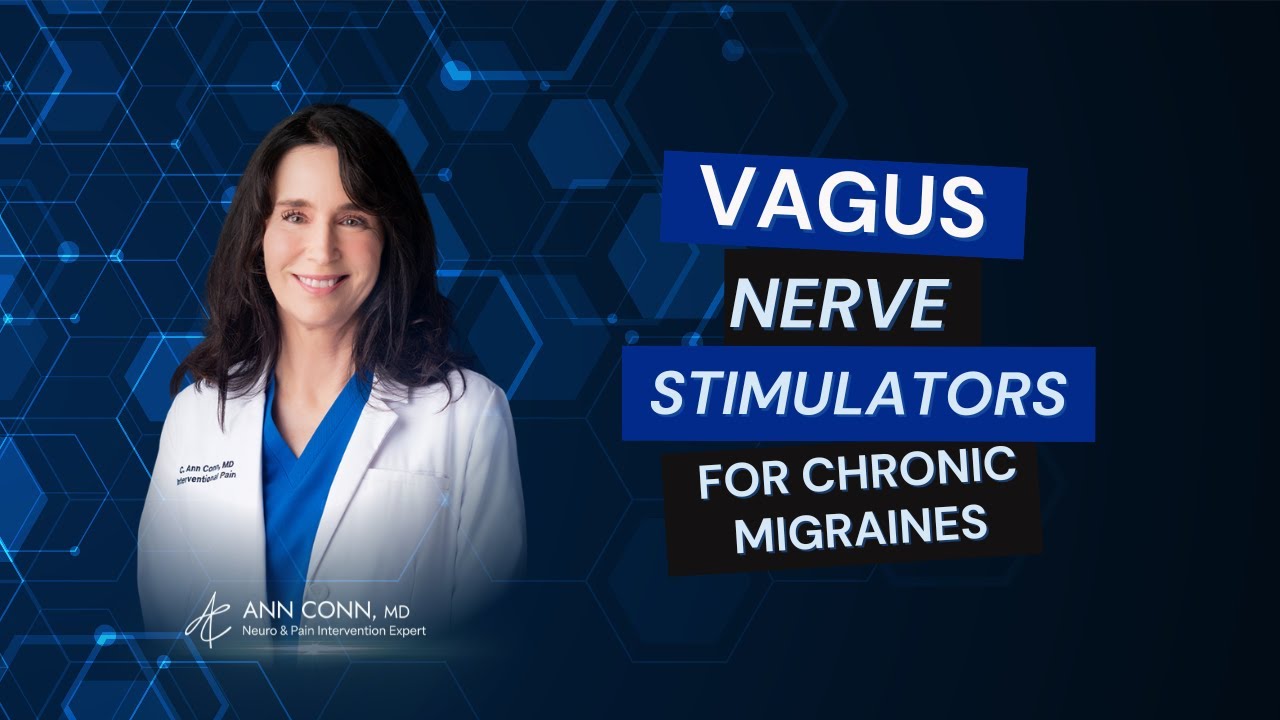 Vagus Nerve Stimulators For Chronic Migraines