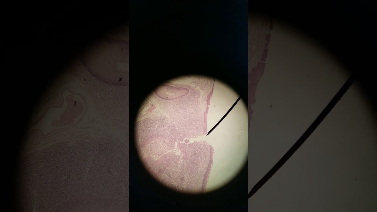 Salivary gland histology