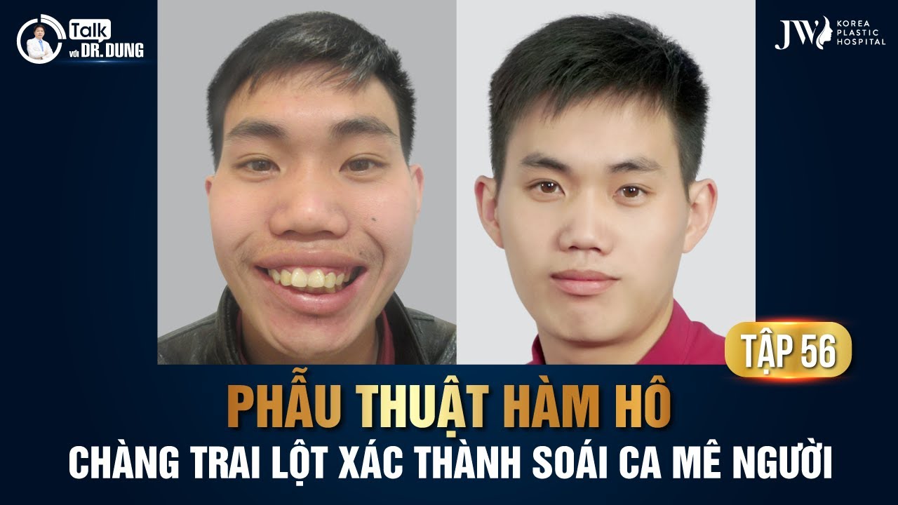 Talk Với Dr Dung (Mùa 3) | Tập 56 – HẬU PHẪU THUẬT HÀM HÔ, 9X THOÁT KHỎI MẶC CẢM NGOẠI HÌNH