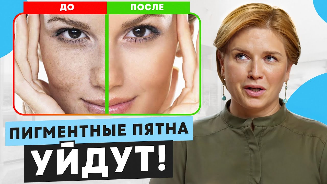 ЛУЧШИЕ способы убрать ПИГМЕНТНЫЕ ПЯТНА! Кожа будет на 10 лет моложе!