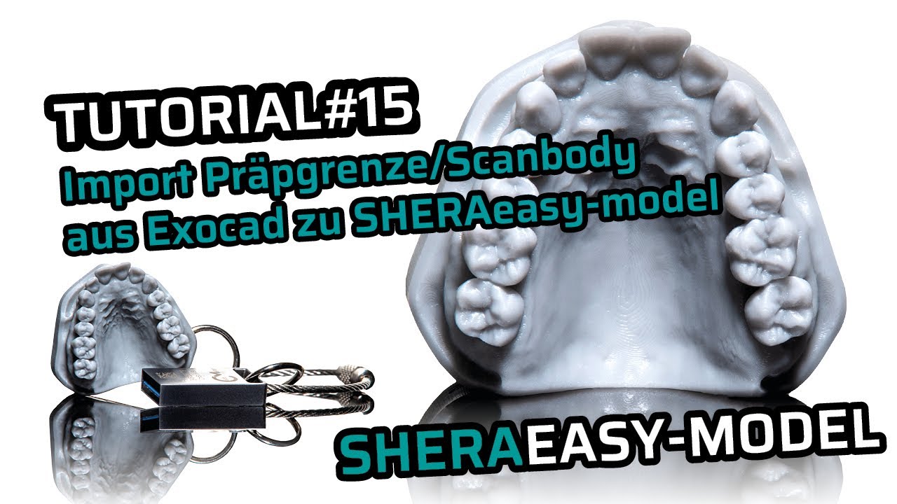 SHERAeasy-model - Import Präpgrenze/Scanbody aus Exocad zu SHERAeasy-model