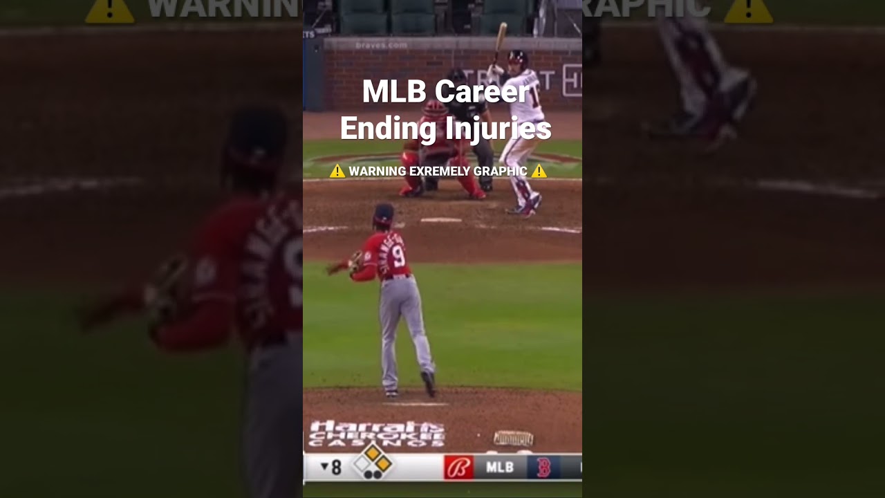MLB Career Ending Injuries