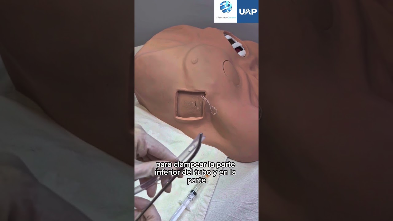 Colocación de tubo pleural