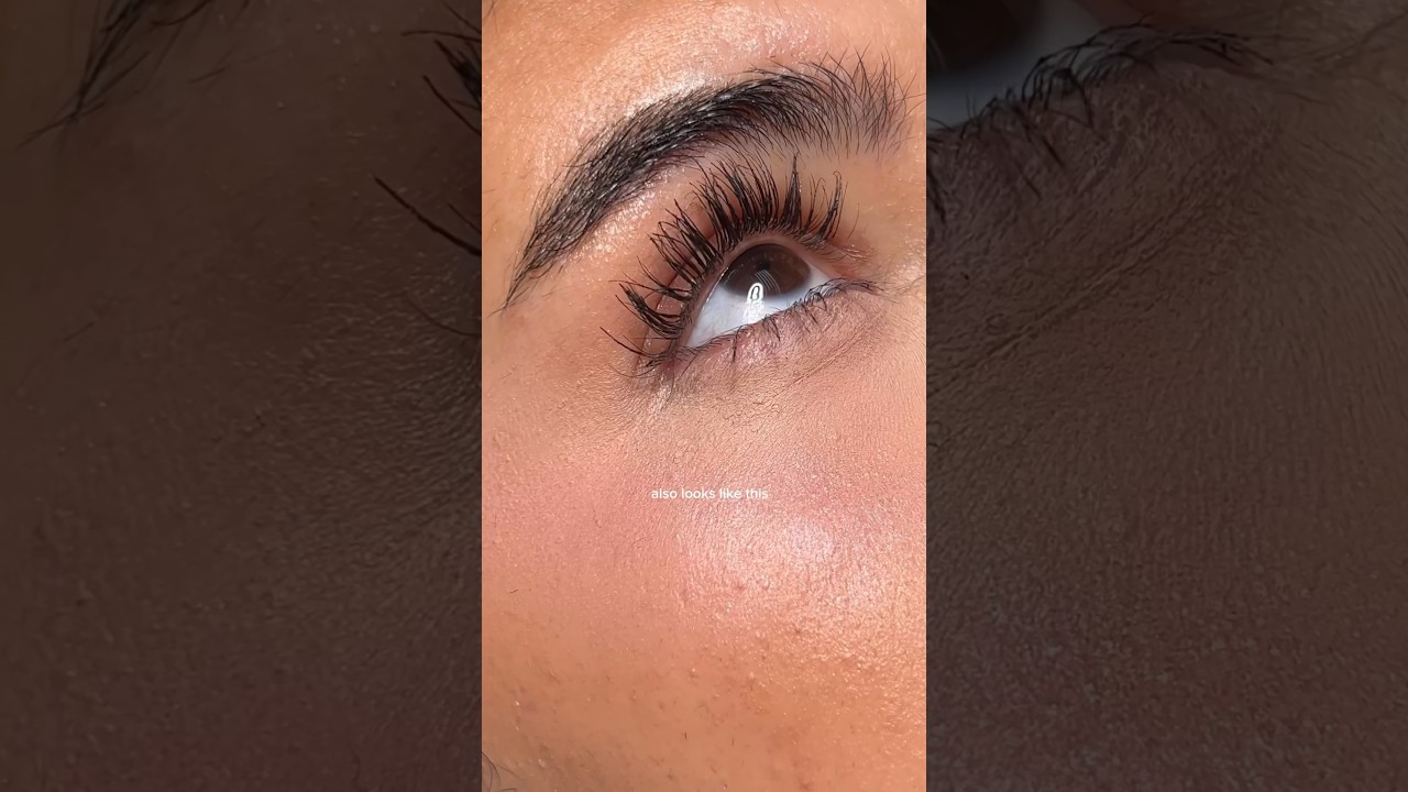 a reminder that all skin texture is normal