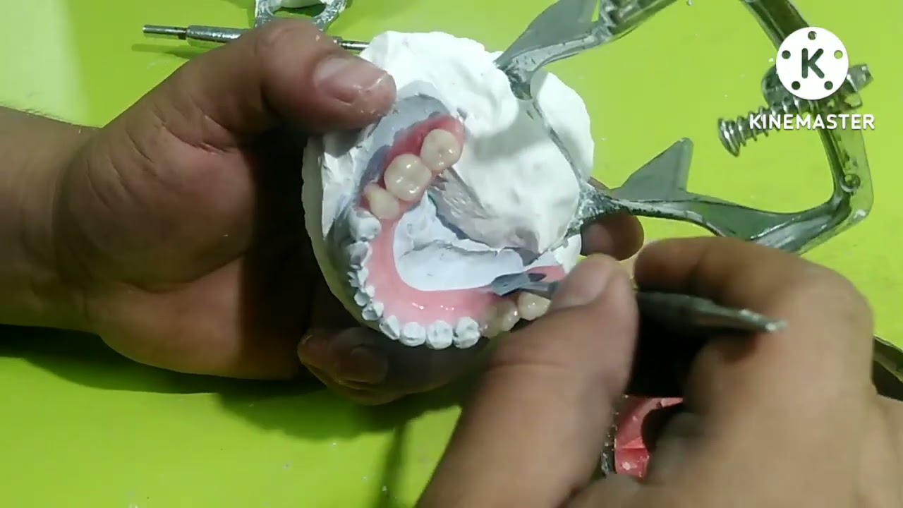 Protesis dentales  flexibles como encerar tus prótesis flexibles 🤯