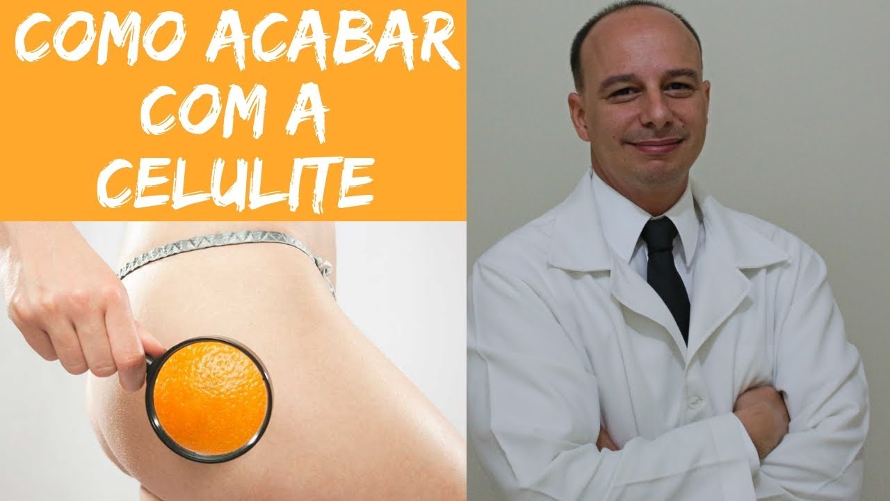 Como Acabar com a Celulite ‖ Dr. Moacir Rosa