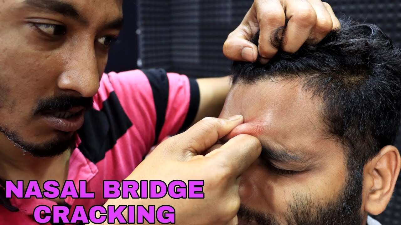 Nasal Bridge Cracking By Master Of Skin Cracks | Head Scratching ASMR | Hair Cracking |Skin Cracking