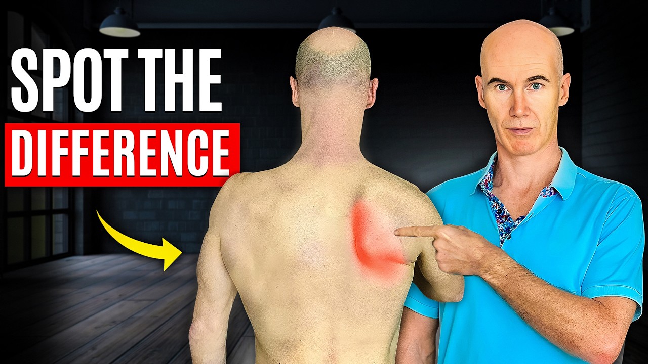 Is it Scoliosis or scapula winging? (You Wish You'd Known This When You Were Younger)