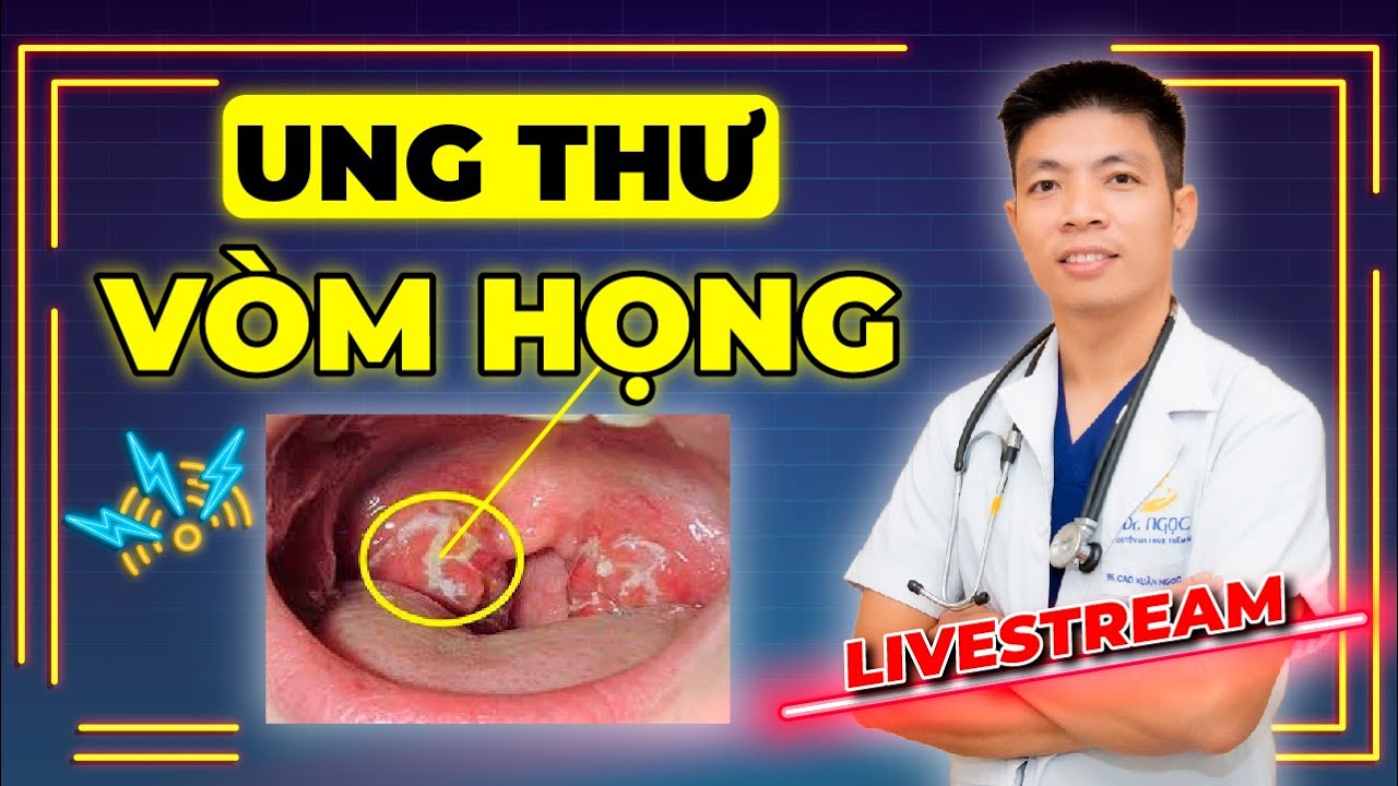 Phát Hiện và Dự Phòng Ung Thư Vòm Họng cùng BS Tai Mũi Họng TƯ