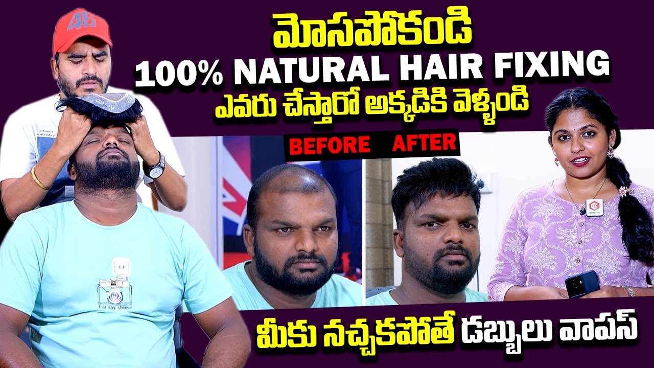 మీకు మీరే కొత్తగా కనిపిస్తారు : John Hair Fixing Centre | Non-Surgical Hair Treatment for Men Hair