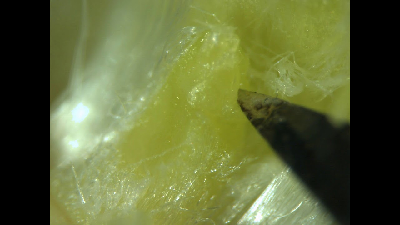 Virus Elimination in Strawberry Using Tissue Culture