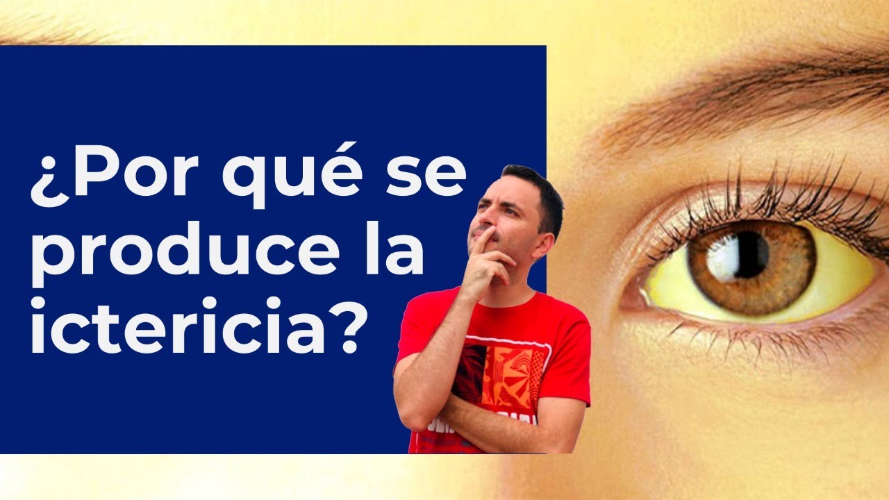 &iquest;Por qu&eacute; se produce la ictericia?