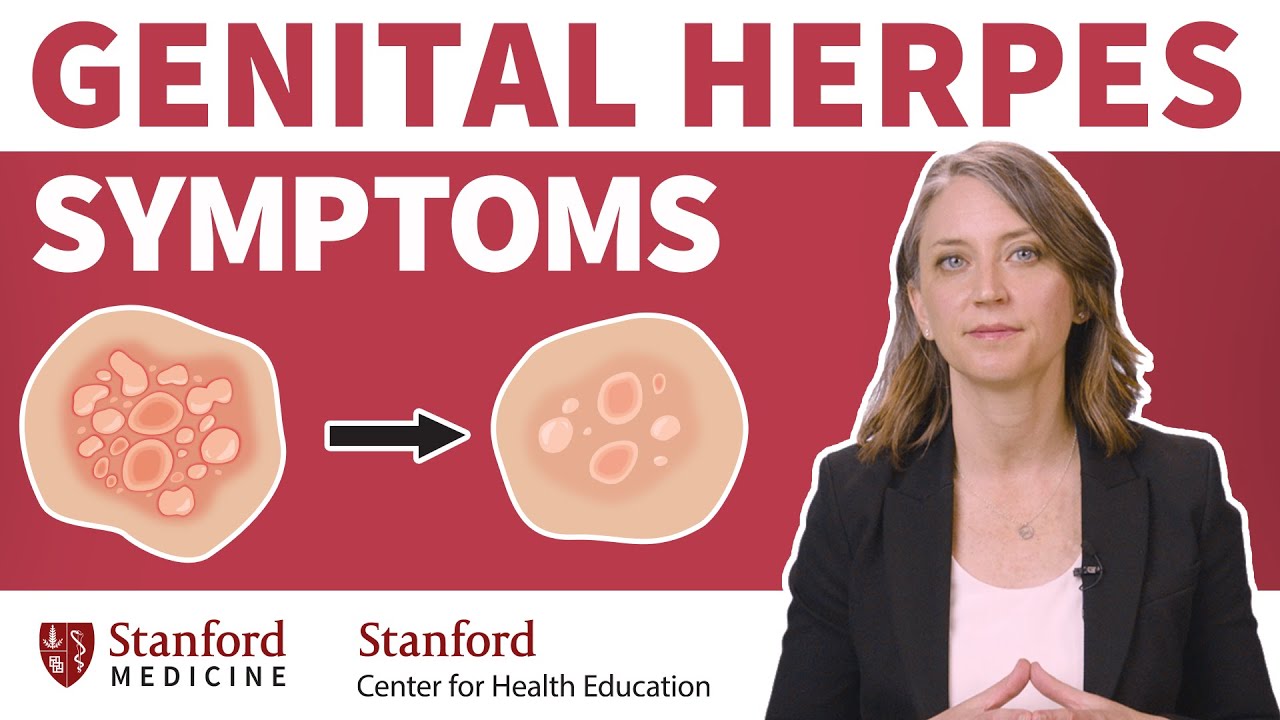 Genital Herpes: Signs and symptoms | Stanford Center for Health Education