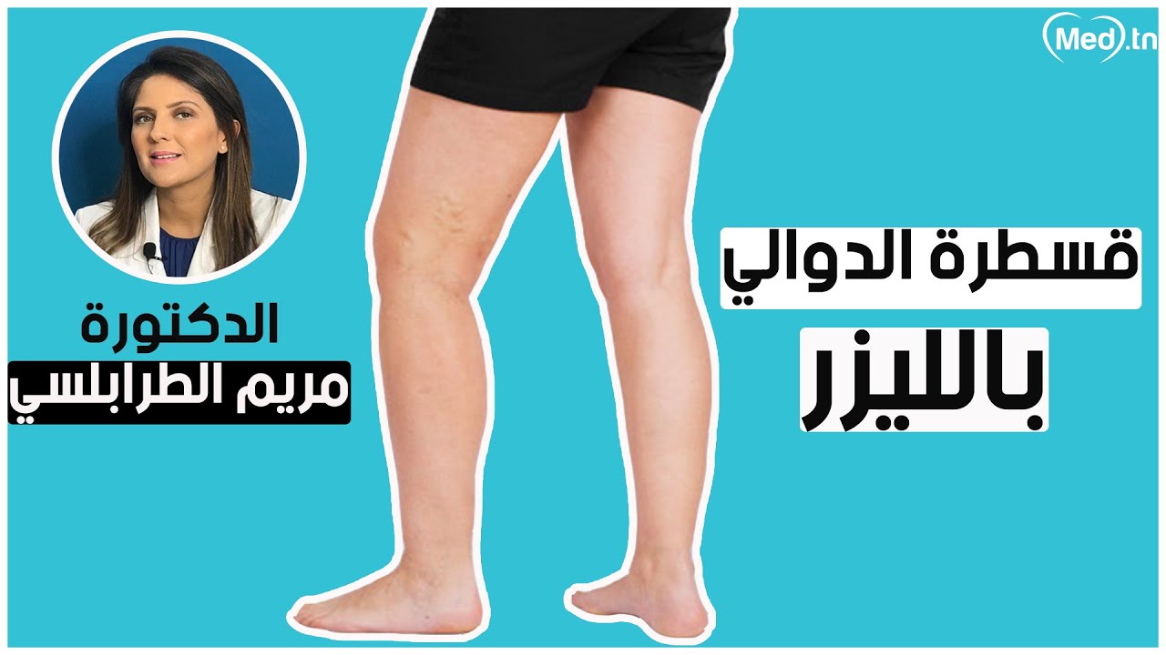 قسطرة الدوالي بالليزر | الدكتورة مريم الطرابلسي الكيلاني
