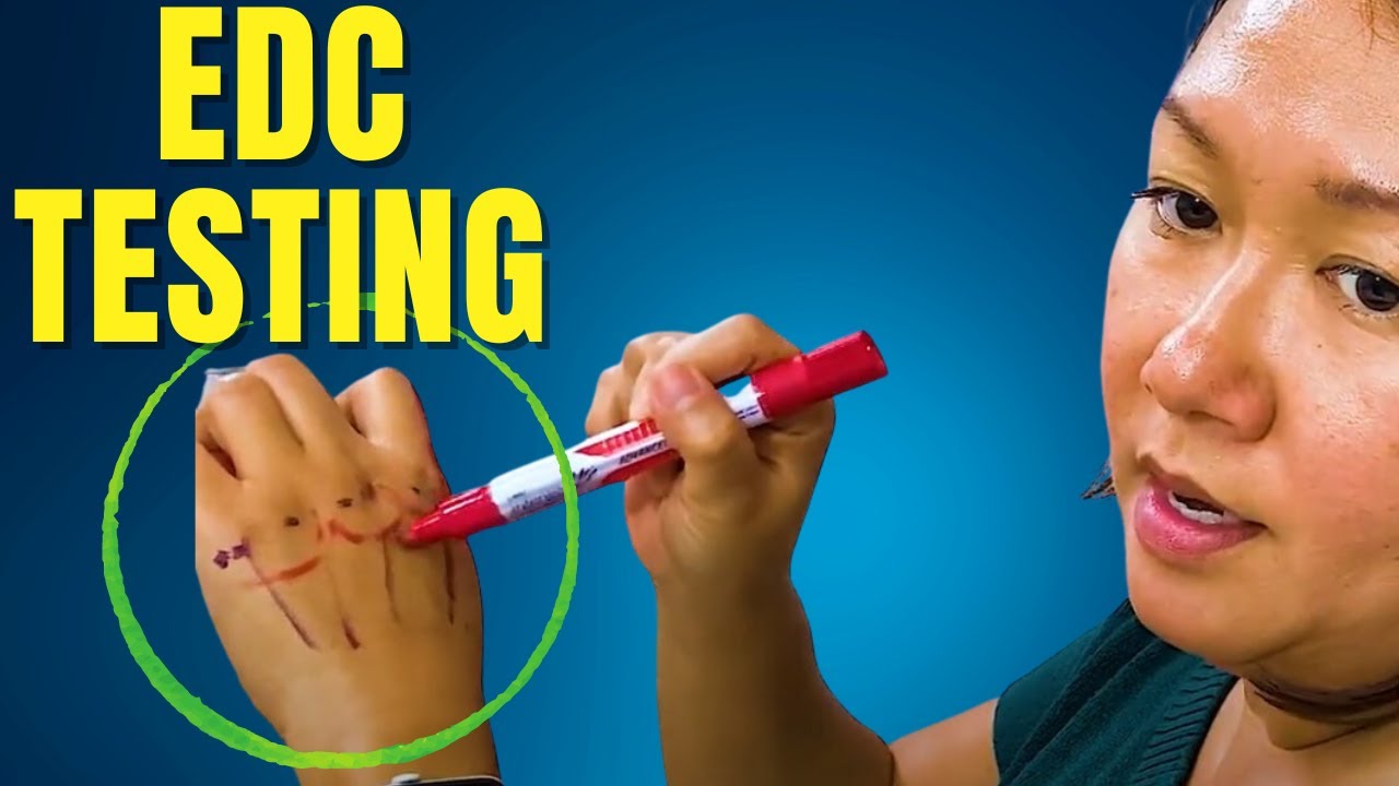 Extensor Digitorum Communis (EDC )Testing and Dynamic Splinting
