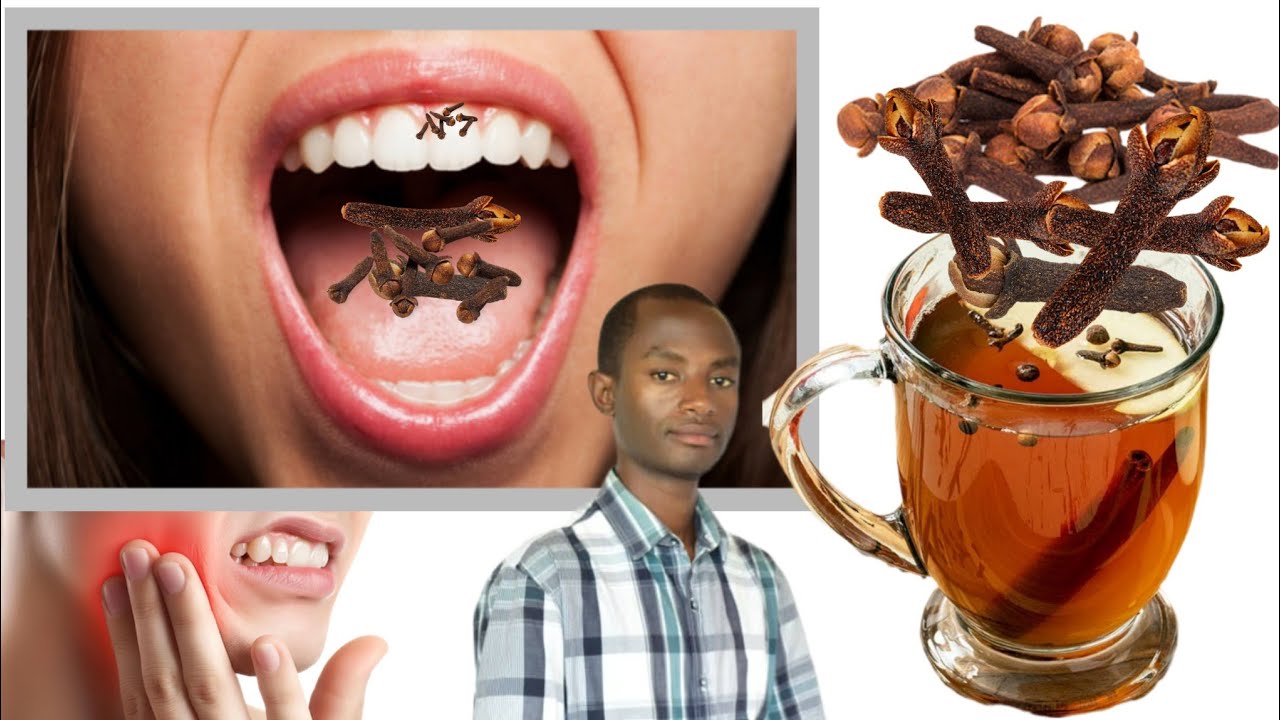 Amenyo yakurembeje! Hekenya clove(karafu).  Ibyo benshi batazi kuri vit B1.