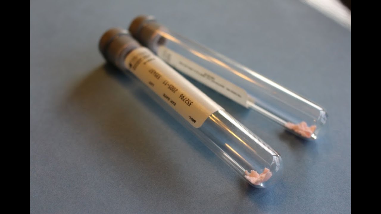 Michigan blood testing in DUI drunk driving cases