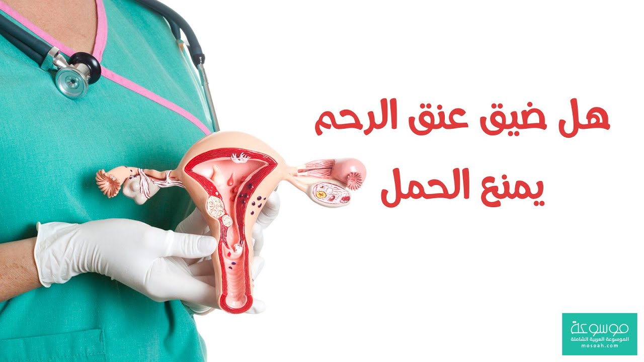 هل ضيق عنق الرحم يسبب العقم ويمنع الحمل ؟
