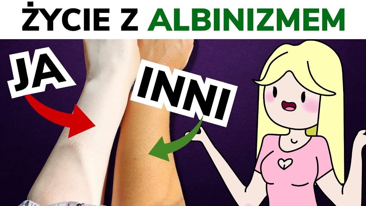 Albinizm - jak żyję z tą chorobą? Pokażę kiedyś twarz? | W Krainie Składów